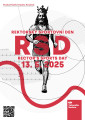 rsd25